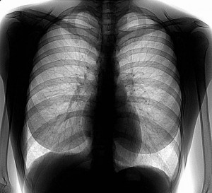 fluorografiya-12