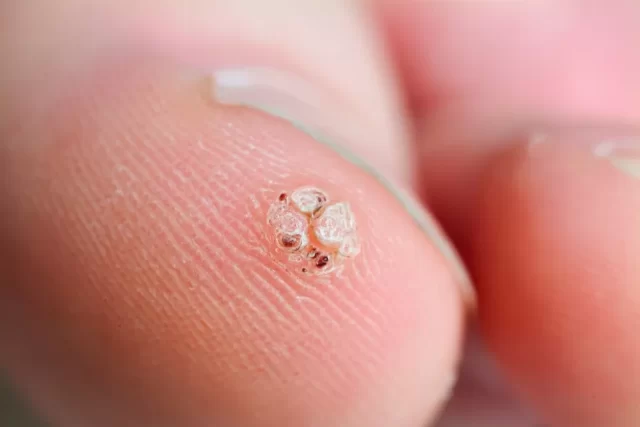 67267e9420a52e0418ea36707556bd6a